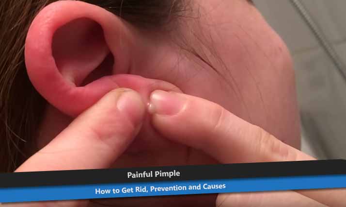 Painful Pimple in Ear
