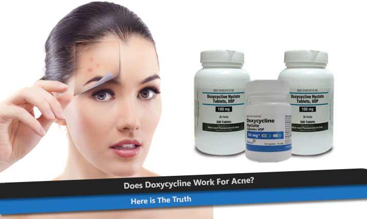 Doxycycline for Acne
