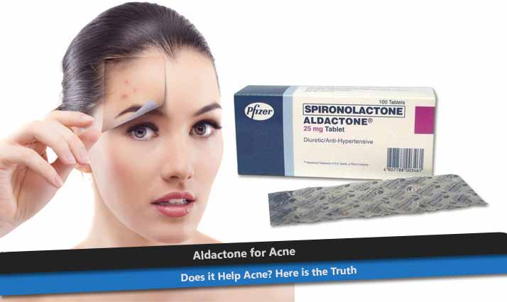 Aldactone for Acne