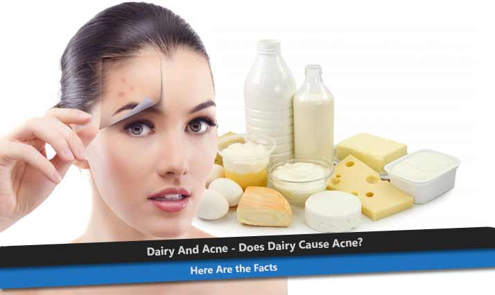 Dairy And Acne